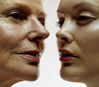 Aging Skin