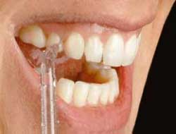 Hammacher Schlemmer The Best Water Jet Dental Cleaner