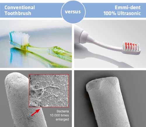Emmi-dent 6 Ultrasonic Toothbrush