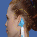 Eardoc: Noninvasive Device to Treat Ear Infections